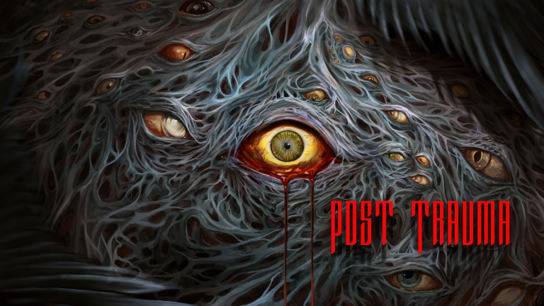 post trauma